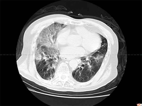 图片 2.png 图片 2.png